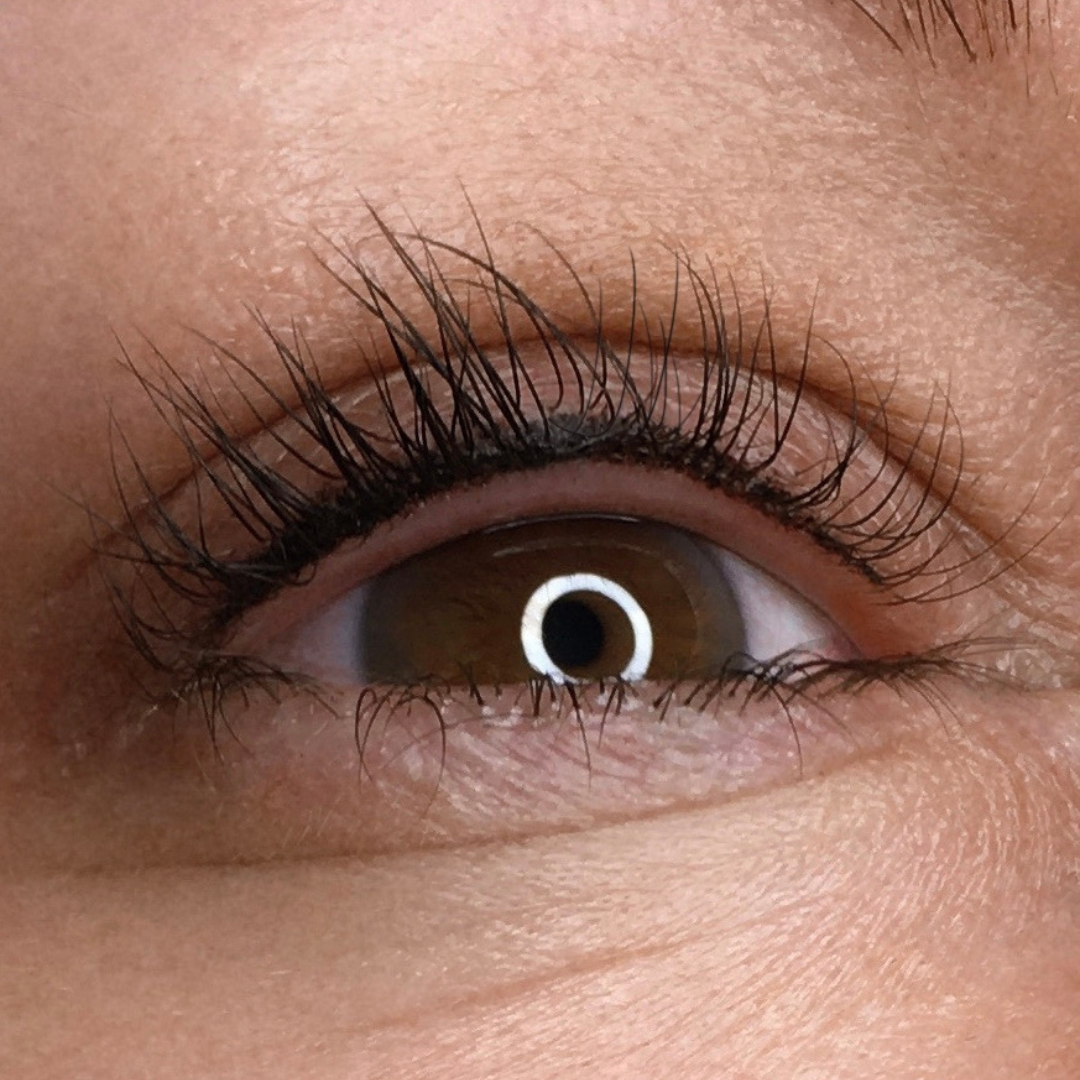 Wimpernkranzverdichtung